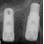 Zimmer-Biomet Tapered Screw-Vent (TSV) image 3