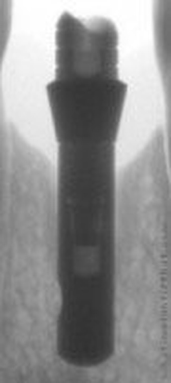 Biolife I main image