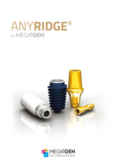 AnyRidge_engweb.pdf