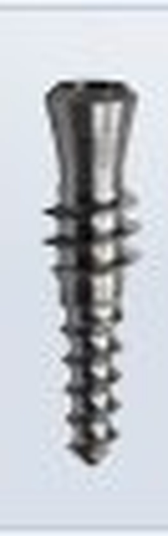 Allfit TPG main image