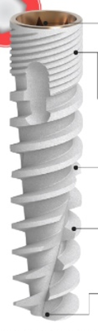 XP main image