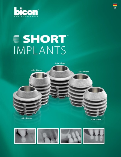 Bicon_ShortImplant_DE.pdf