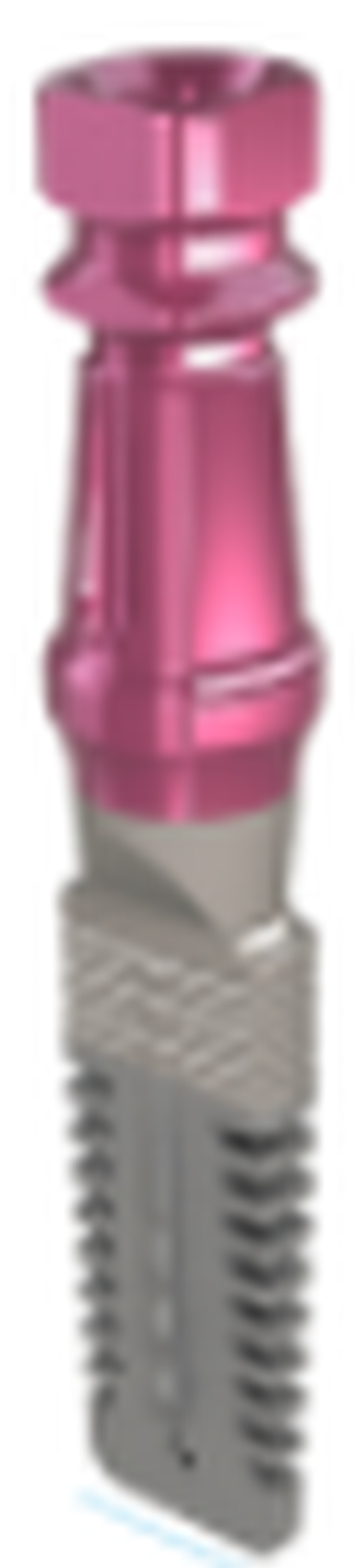 Rex Implant main image