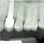 Dentsply Sirona XiVE S (Friadent) image 6