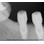 FIXUM Dental Implants Fixum image 11