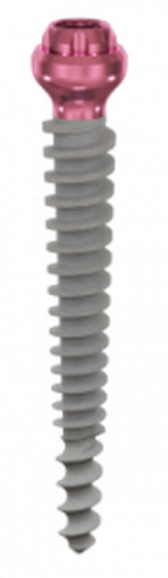 Compressive MP main image