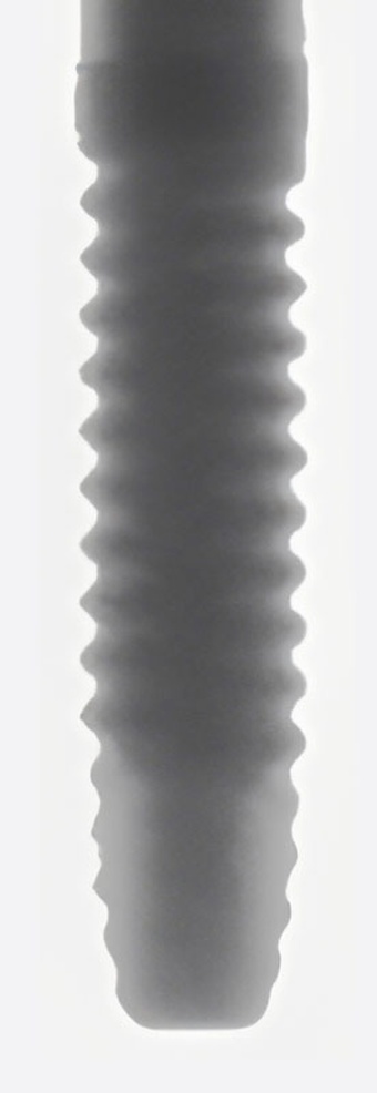 OVD Implant 2mm collar RBT main image