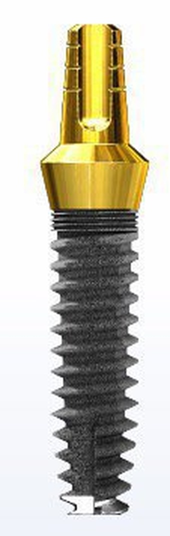 Immediate Stabilization (ISI) Crown & Bridge (CB) main image