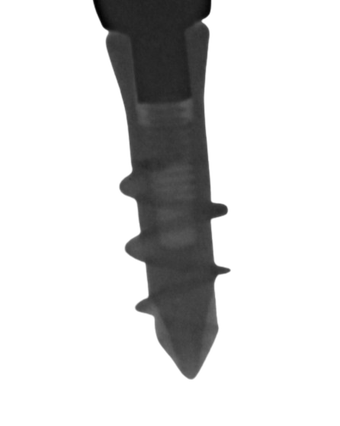 ETA CH main image