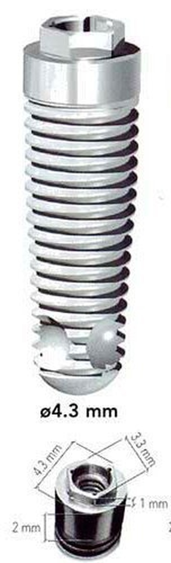 External Hex Conic main image