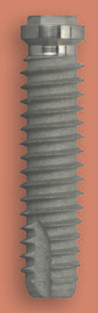CDT main image