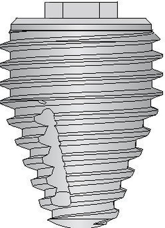 External Hex Max main image