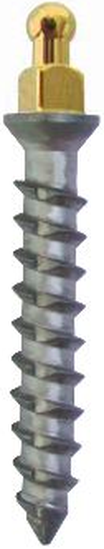 Mini Impianto Sferico (SF) main image