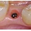 Biotech Dental Kontact image 1
