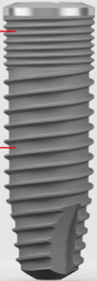 Gingival Level main image
