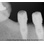 FIXUM Dental Implants Fixum image 2