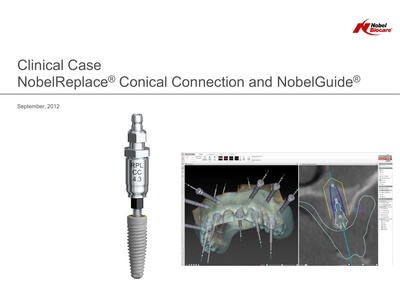 Clinical-case_NobelGuide_Andrew-Dawood.pdf