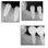 FIXUM Dental Implants Fixum image 14