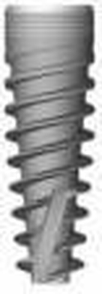 Tidal Spiral Implant System TSI main image
