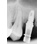 FIXUM Dental Implants Fixum image 4