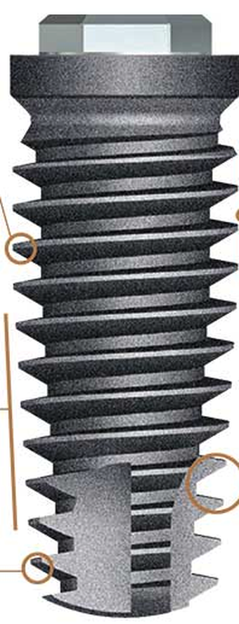 BR system main image