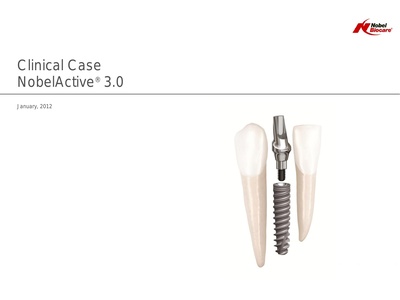 Clinical-case_NobelActive3-0_Philip-Russe.pdf