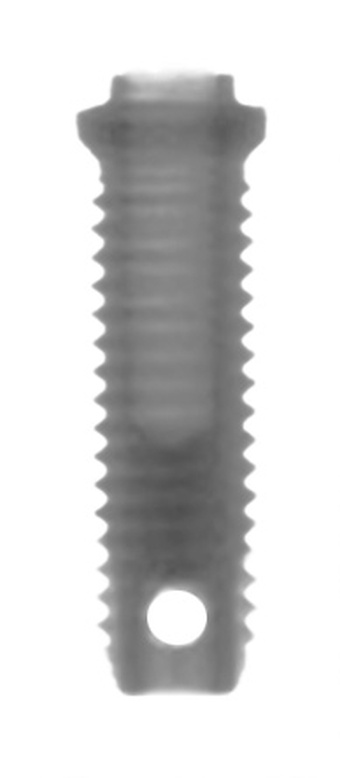 Branemark Mk I (Round hole) main image