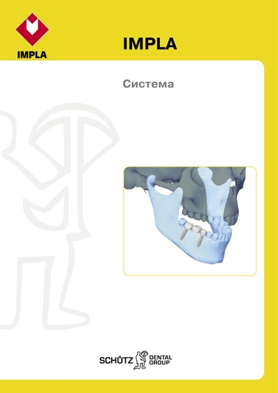 201308_IMPLA_System_RUS.pdf