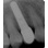 Implant Direct ScrewPlant image 3