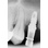 FIXUM Dental Implants Fixum image 7