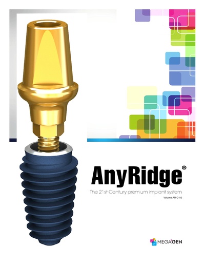 AnyRidge_Implant_System.pdf