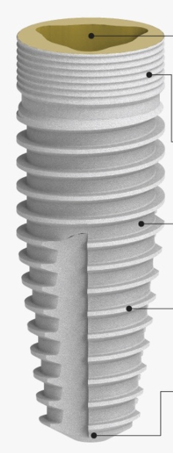 Tricanal main image