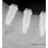 FIXUM Dental Implants Fixum image 10