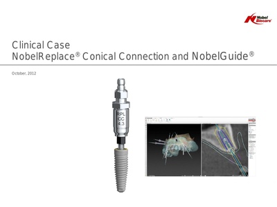 Clinical-Case_NobelGuide_Alessandro-Pozzi.pdf
