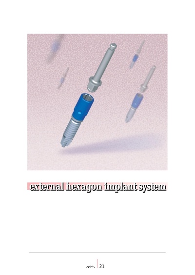 External20hexagon20Implant.pdf