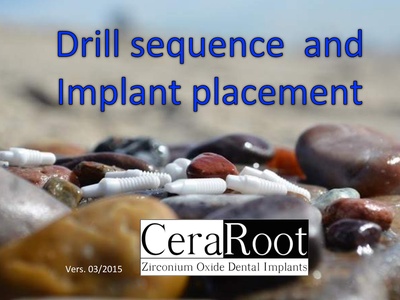 ceraroot-implant-placement-2015.pdf
