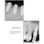 FIXUM Dental Implants Fixum image 15