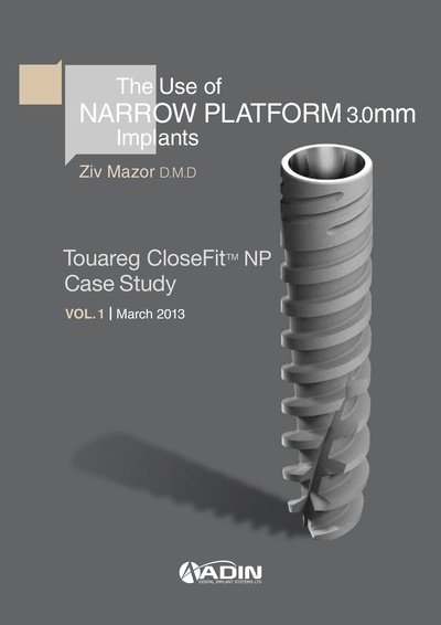 NP-Case-Study-Ziv-Mazor-EMAIL.pdf