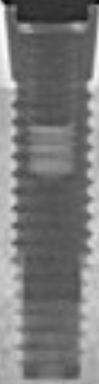 Miniplant main image