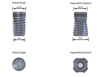Quad Internal Hex main image