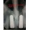 Implant Direct ScrewPlant image 4
