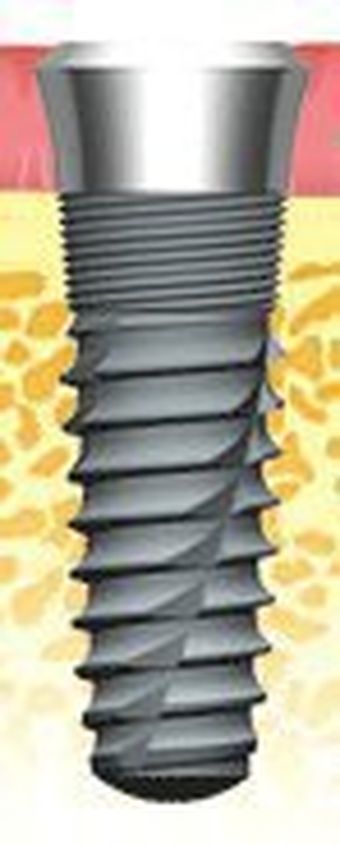 Atlas Internal Taper main image