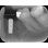Dentsply Sirona Osseospeed S (Astra Tech) image 3