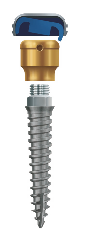 LOCATOR Overdenture Implant System main image