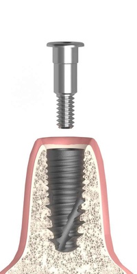 Cover screw