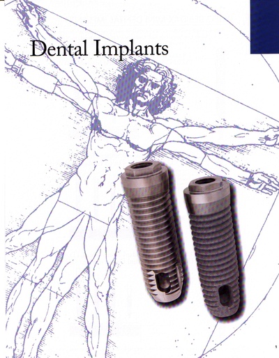 implants.pdf