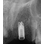 TBR Ide Oct-In image 5