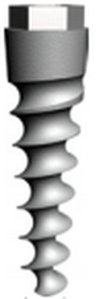 Solo modular titanium main image