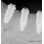 FIXUM Dental Implants Fixum image 6