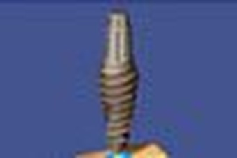 Nobel Active-External main image